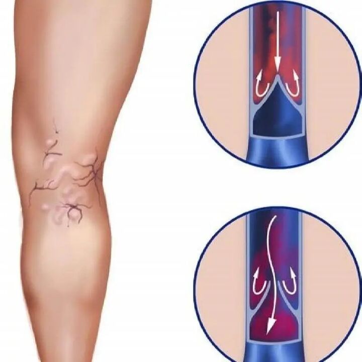 Bécs veresége
